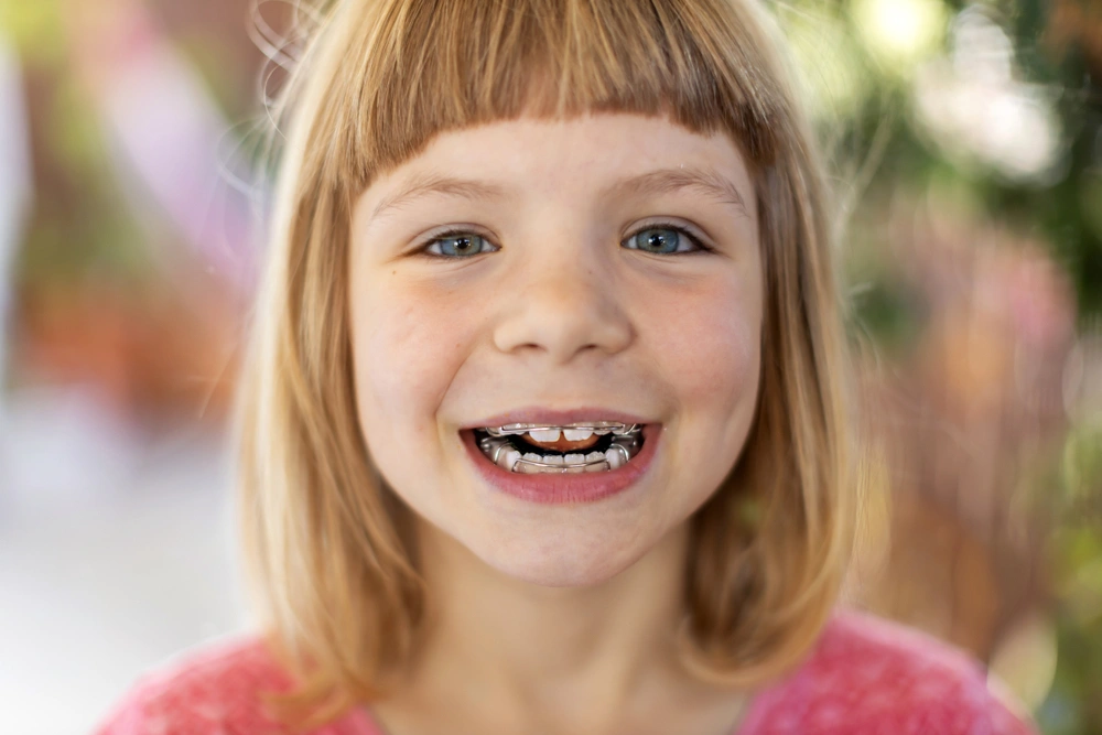 Young child smiling with an orthodontic appliance